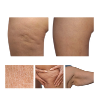 Abdominal Fat Reduction Massage Oil for Rapid Fat Burning and Skin Firming Zenithral