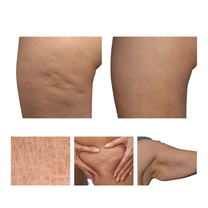 Abdominal Fat Reduction Massage Oil for Rapid Fat Burning and Skin Firming Zenithral